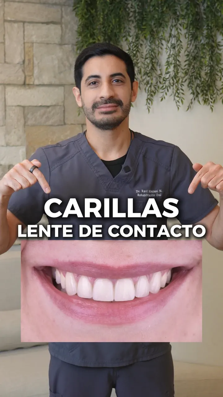 Portada del video: Carillas lente de contacto